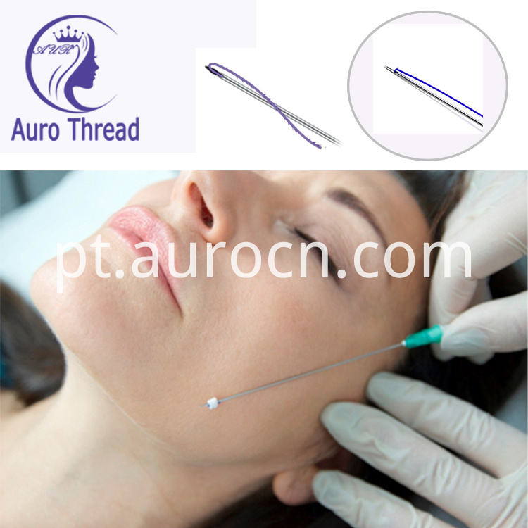pdo thead face lift pdo thead face lift
